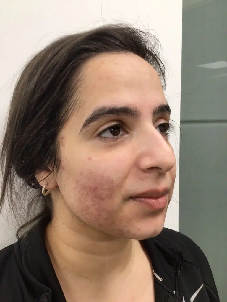 photo_EjEmbM_$1$4qE7W$S0XRUC0.v5AhpRquMCqHN.$1$hd93pEtG$tRt572By3Mgq7KuP1al