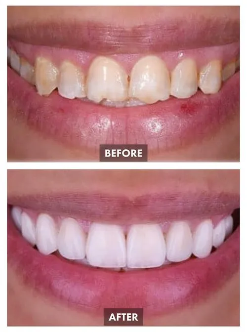 6595569b7d5dc25a7943e9bb_Group 1089-p-500