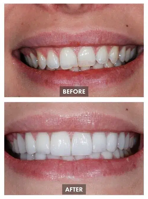 6595569c535215a416ce76ee_Group 1091-p-500