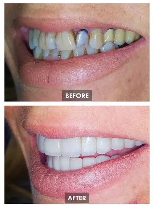 6595569f9d39c8cff11fce48_Group 1090-p-500