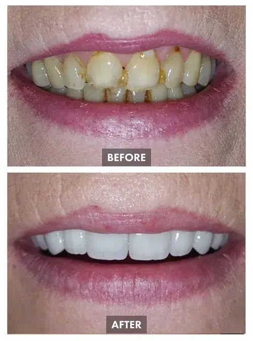 659bda7bfccf5c14ab8eaa09_Group 1100-p-500