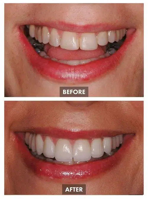 659bda7d056be45029176345_Group 1102-p-500