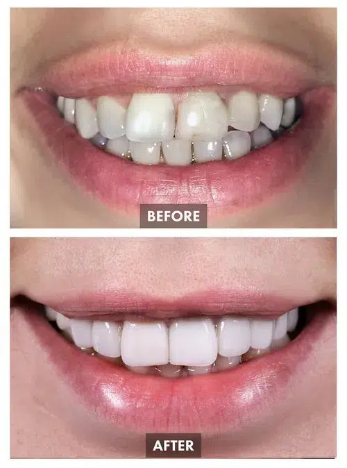 659bda7d727dec5fa94edeeb_Group 1101-p-500