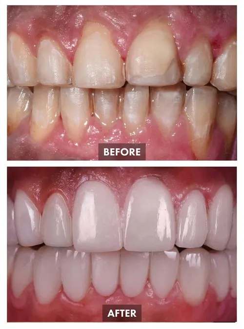 659bda7dac962913177e20a6_Group 1097-p-500