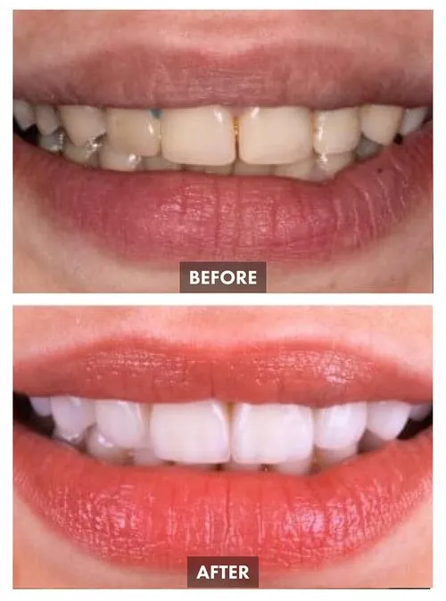 659bda7df99858ea860b5b29_Group 1096-p-500