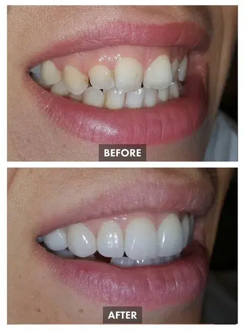 659bda80541e78000e48c9fb_Group 1098-p-500