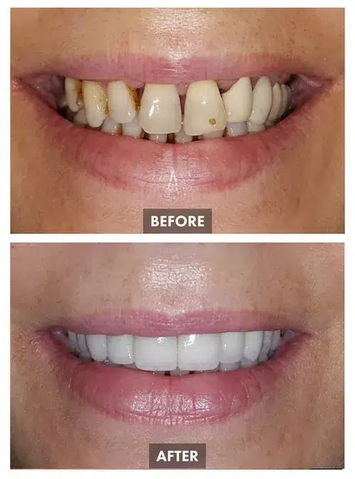 659bda838251b477cab4bc03_Group 1099-p-500