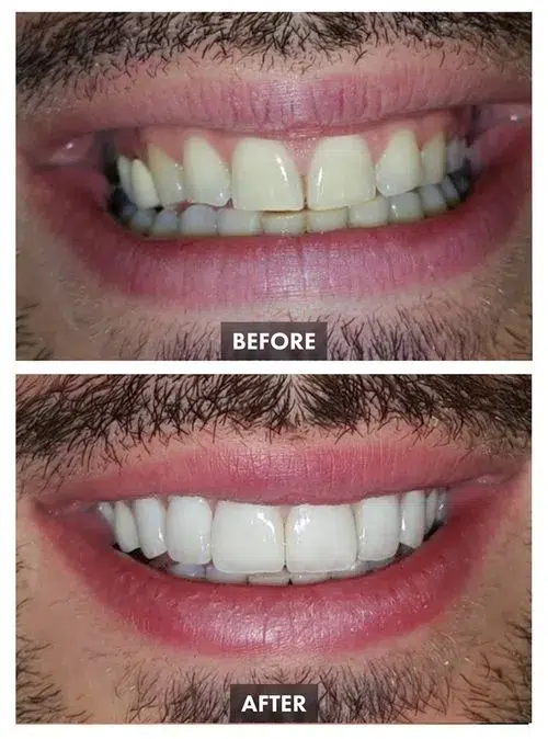 65a5456d33d6d7f52c13e702_Group 1110-p-500