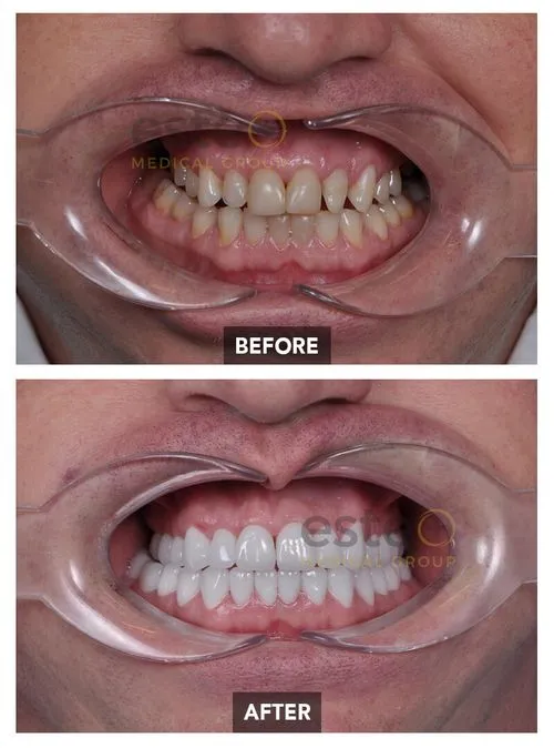 65e98f846e2b1b4281719fcf_Alex-1-p-500