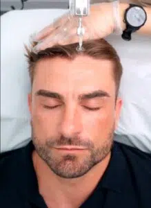 Ryan MCT Hair Restoration Treatment